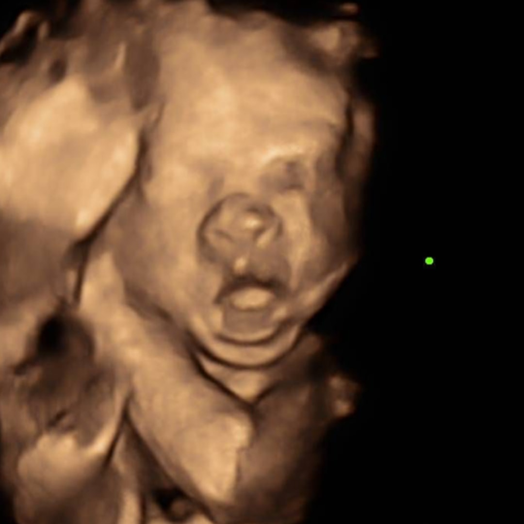 Photo shared by Hannah for their Babylist baby registry.