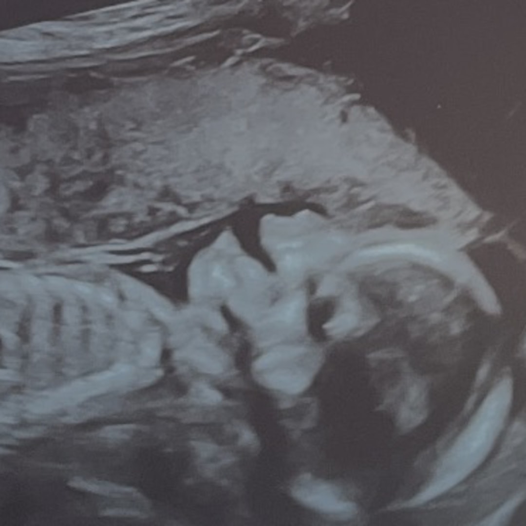 Photo shared by Julenney for their Babylist baby registry.