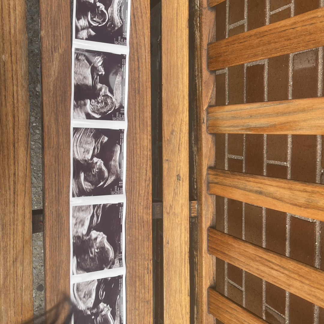 Photo shared by Dennis for their Babylist baby registry.