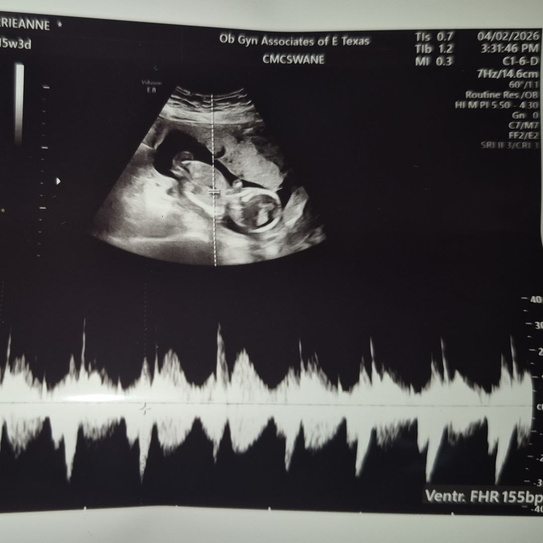 Photo shared by Carrieanne for their Babylist baby registry.