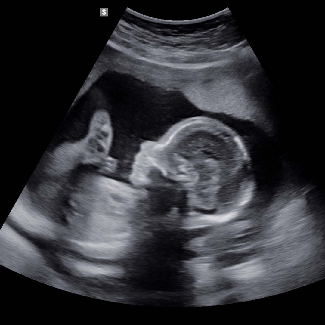 Photo shared by Aly for their Babylist baby registry.
