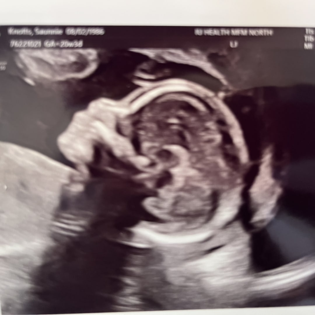 Photo shared by Saunnie for their Babylist baby registry.