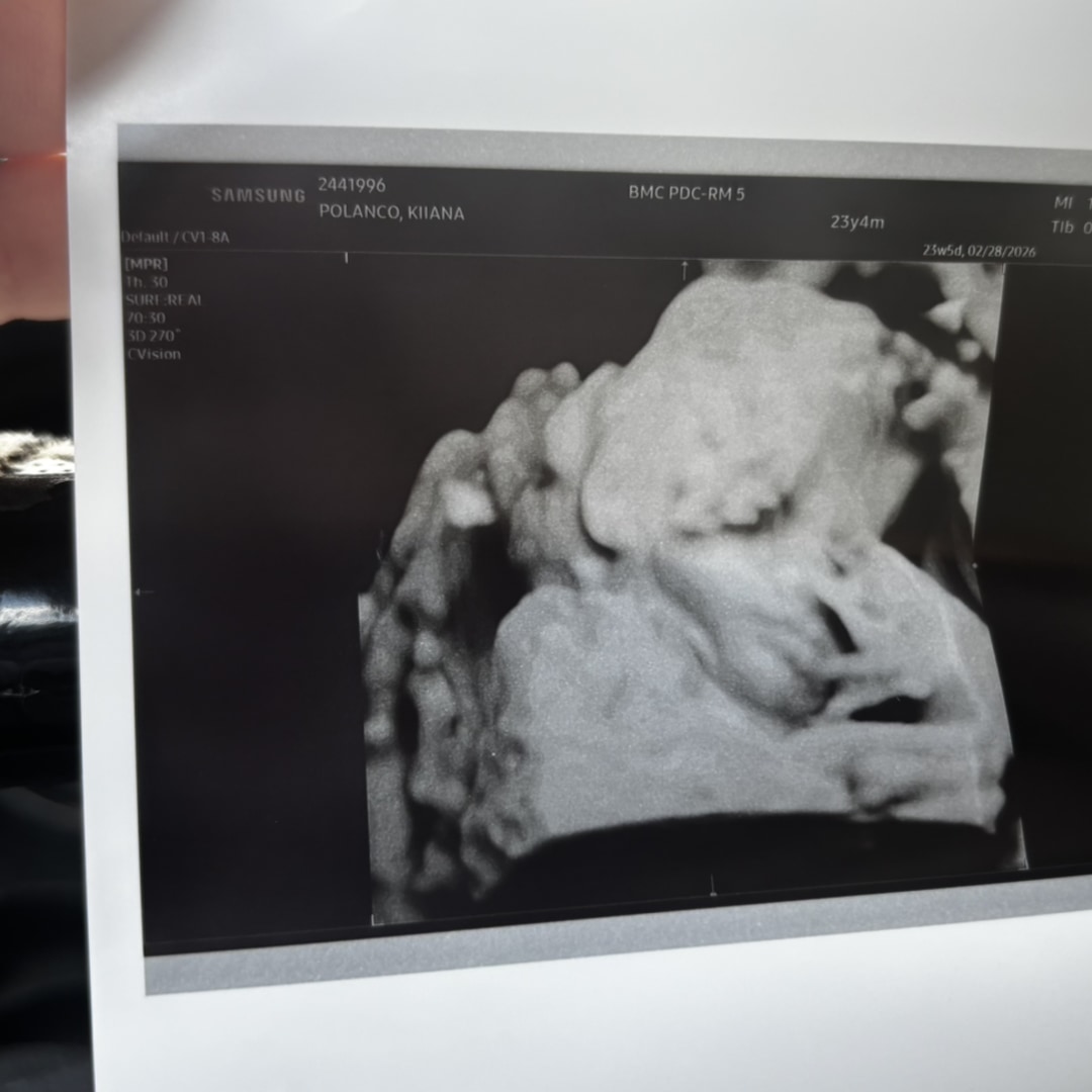 Photo shared by Kiiana for their Babylist baby registry.