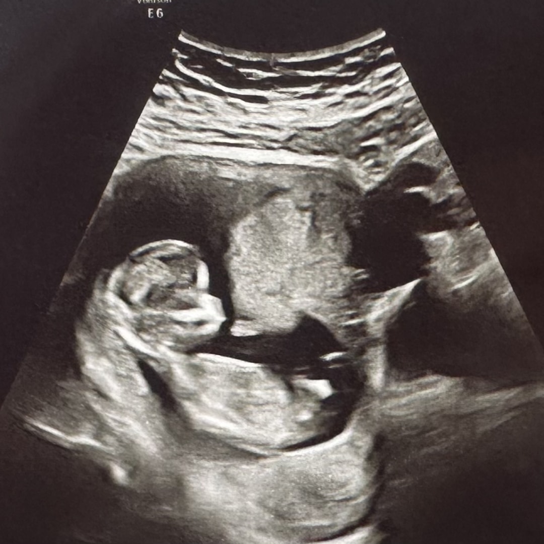 Photo shared by Layla & Micah for their Babylist baby registry.