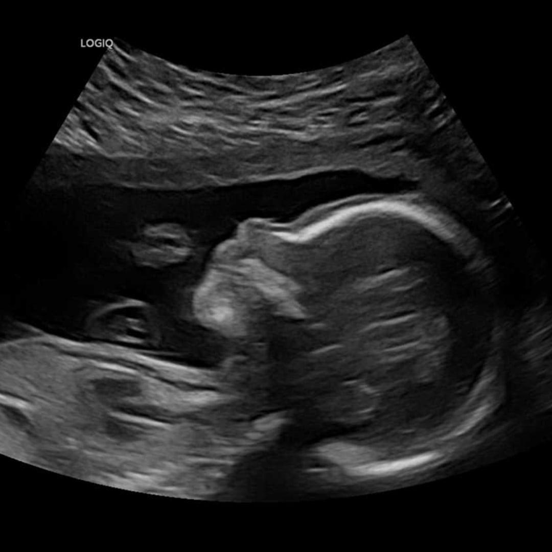 Photo shared by Imogen for their Babylist baby registry.