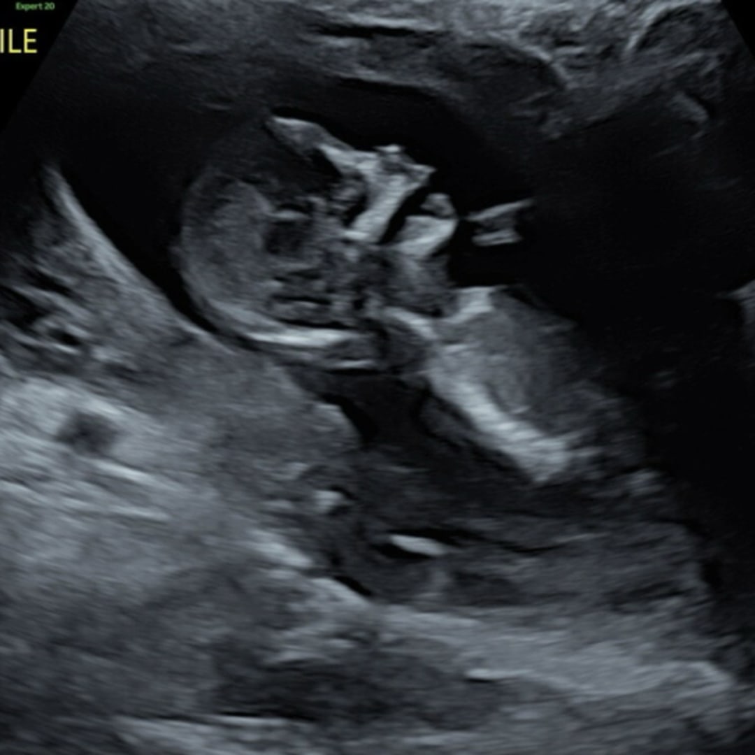 Photo shared by Ashley for their Babylist baby registry.