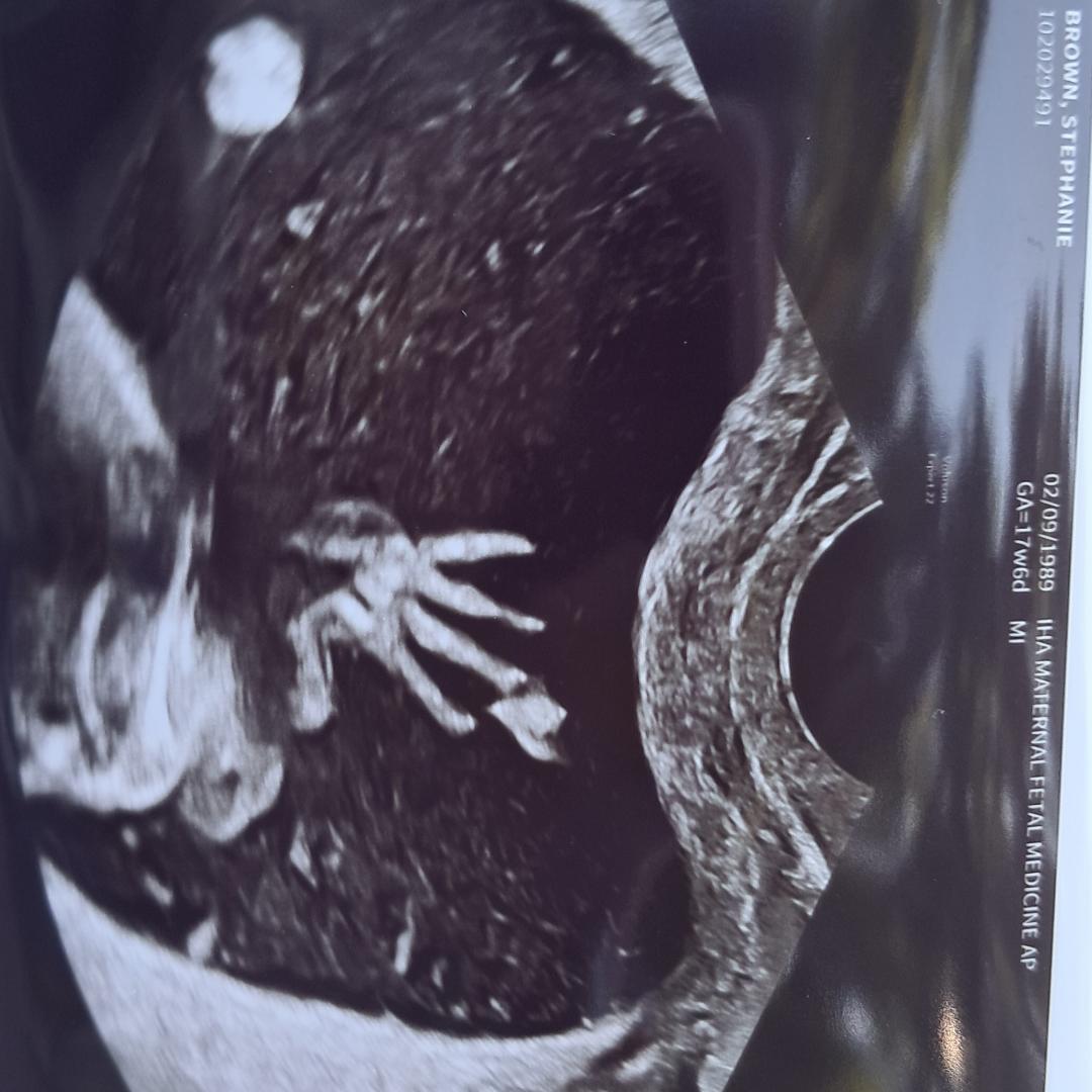 Photo shared by Stephanie for their Babylist baby registry.