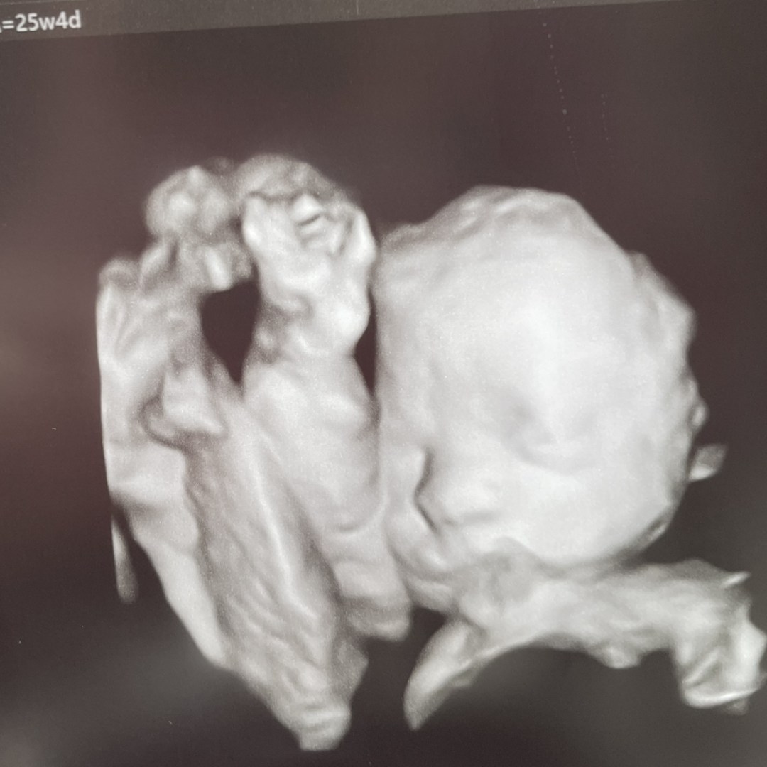 Photo shared by Monica for their Babylist baby registry.