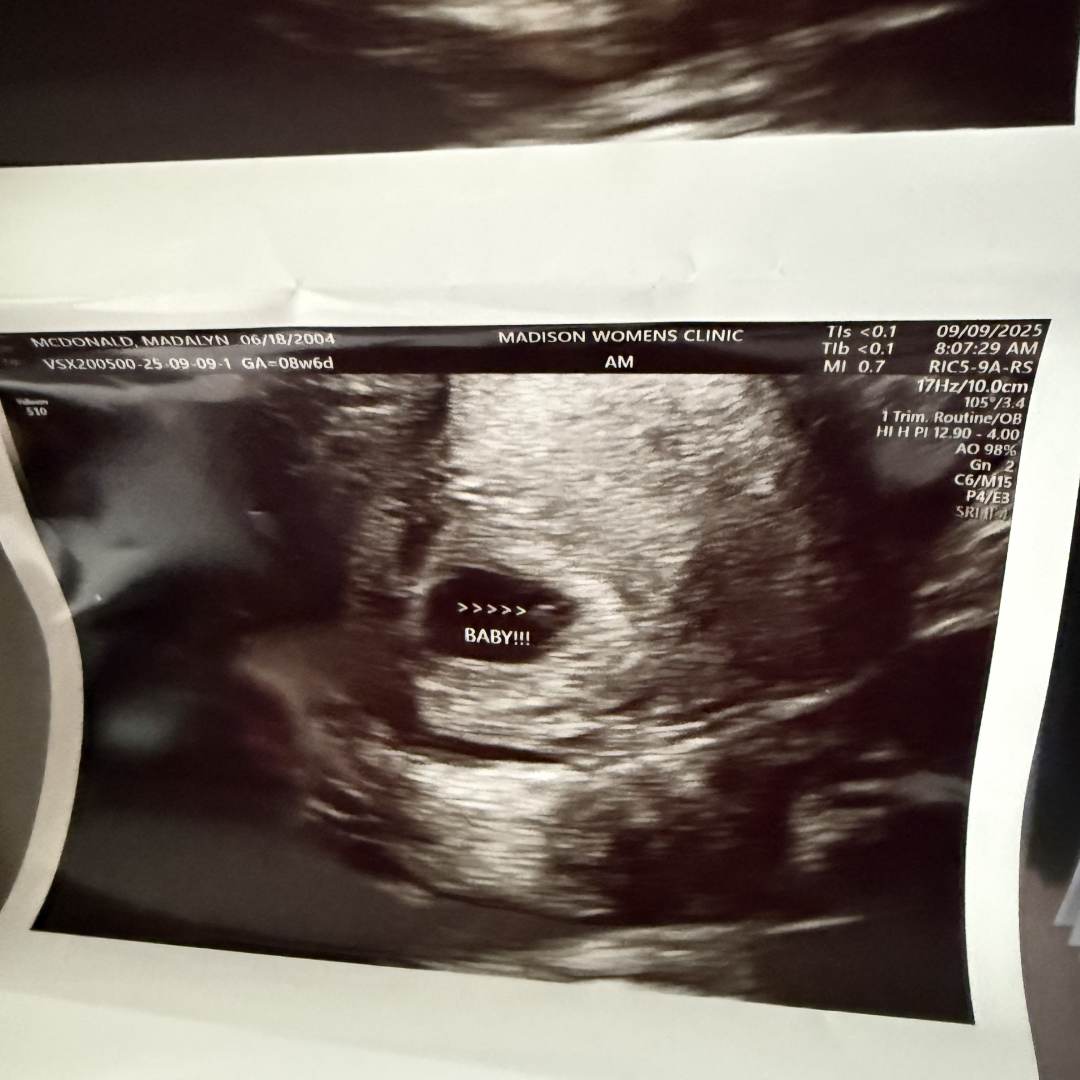 Photo shared by Madalyn for their Babylist baby registry.