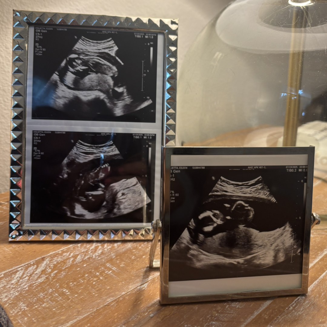 Photo shared by Eileen for their Babylist baby registry.