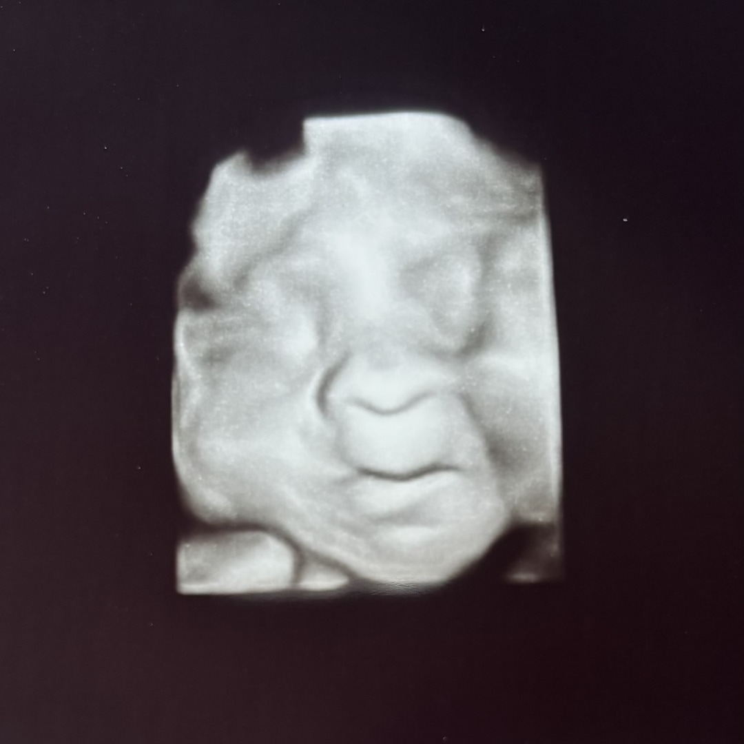 Photo shared by Keana for their Babylist baby registry.