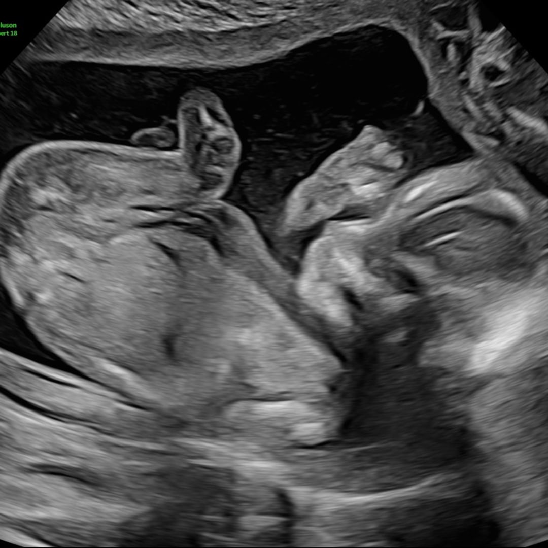 Photo shared by Caroline for their Babylist baby registry.