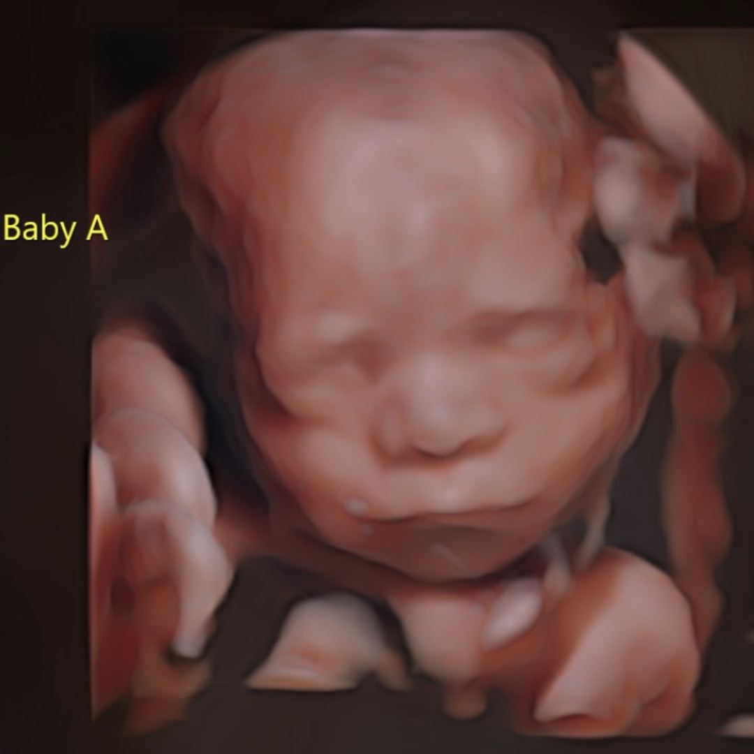 Photo shared by Kara for their Babylist baby registry.