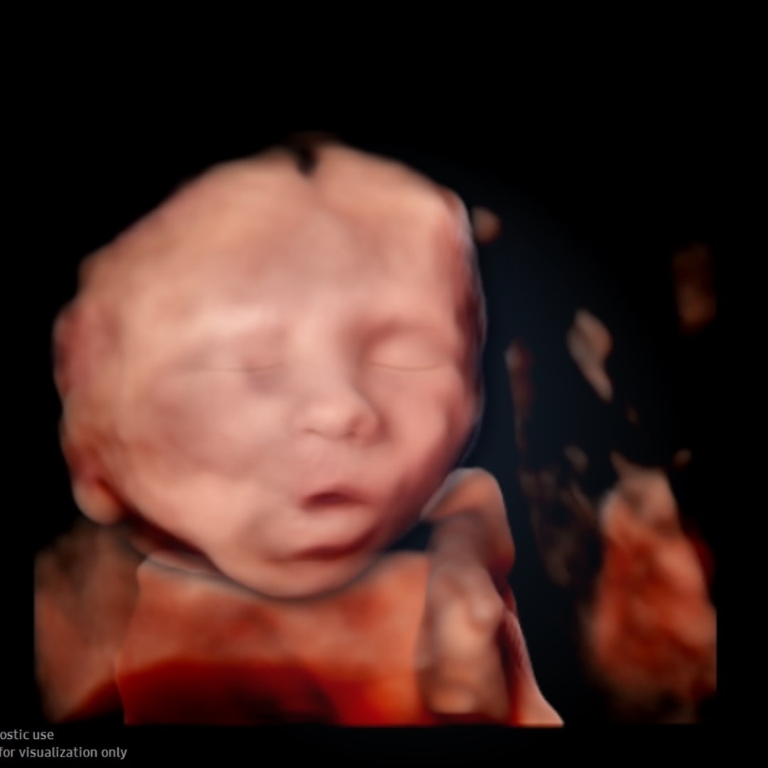 Photo shared by Brooke for their Babylist baby registry.