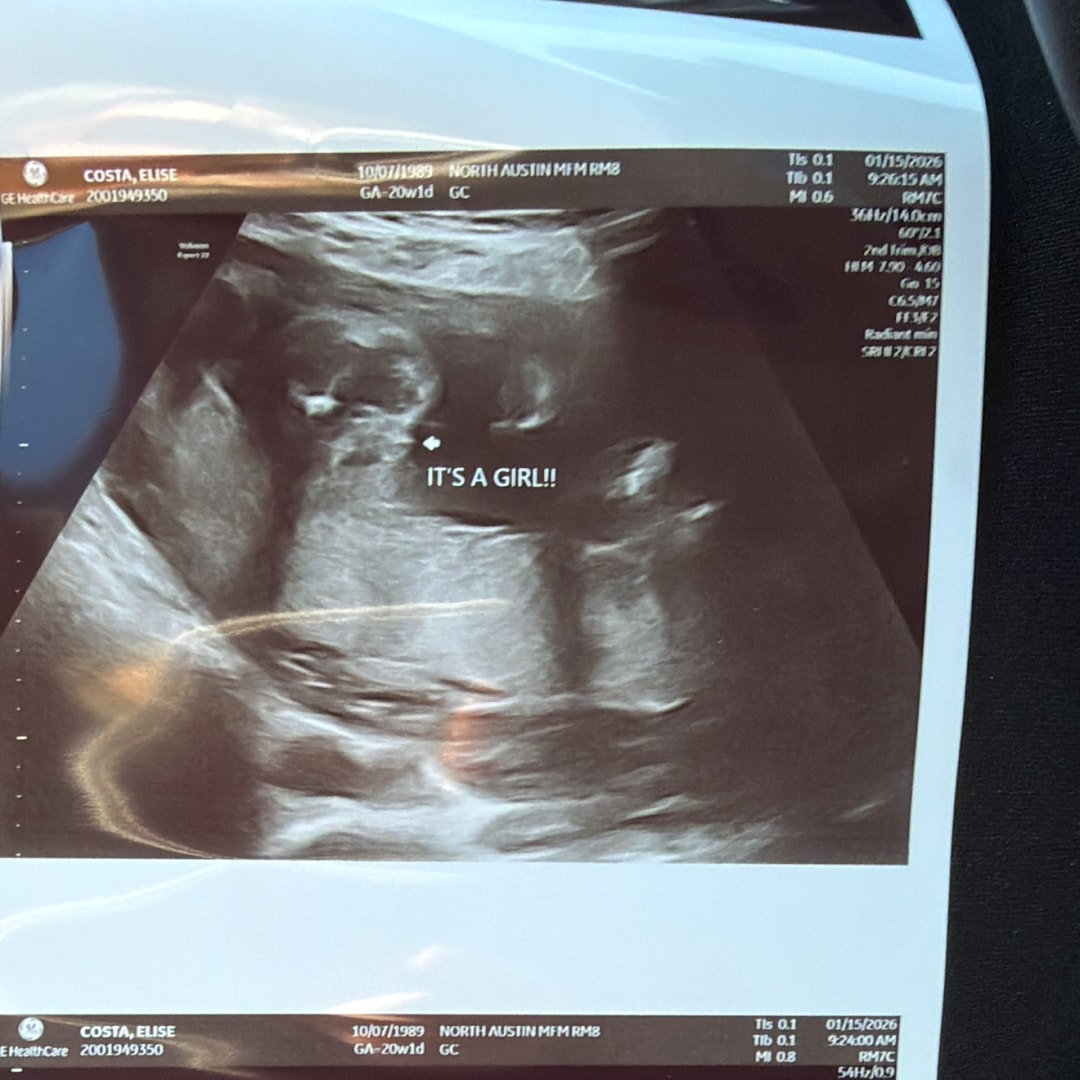 Photo shared by Elise for their Babylist baby registry.