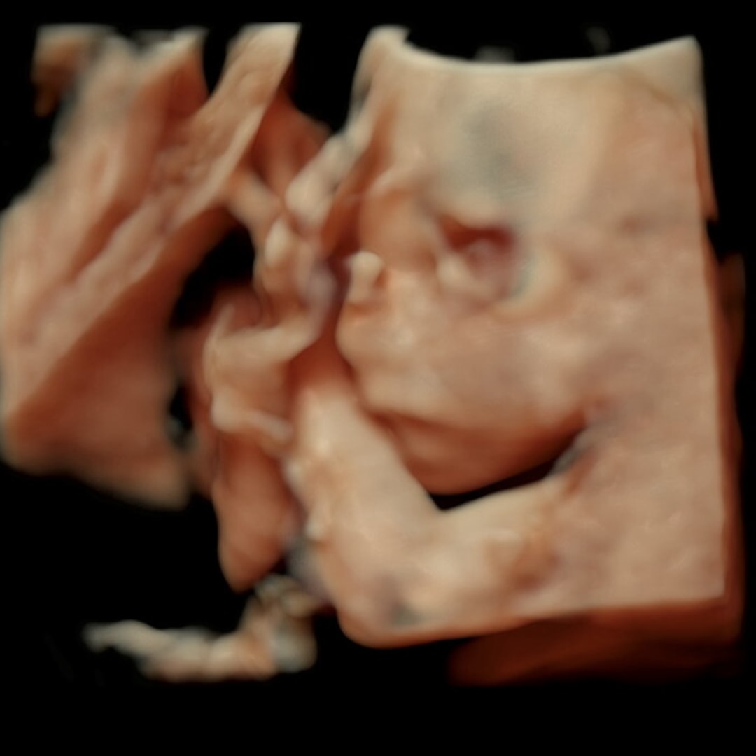 Photo shared by Jessica for their Babylist baby registry.