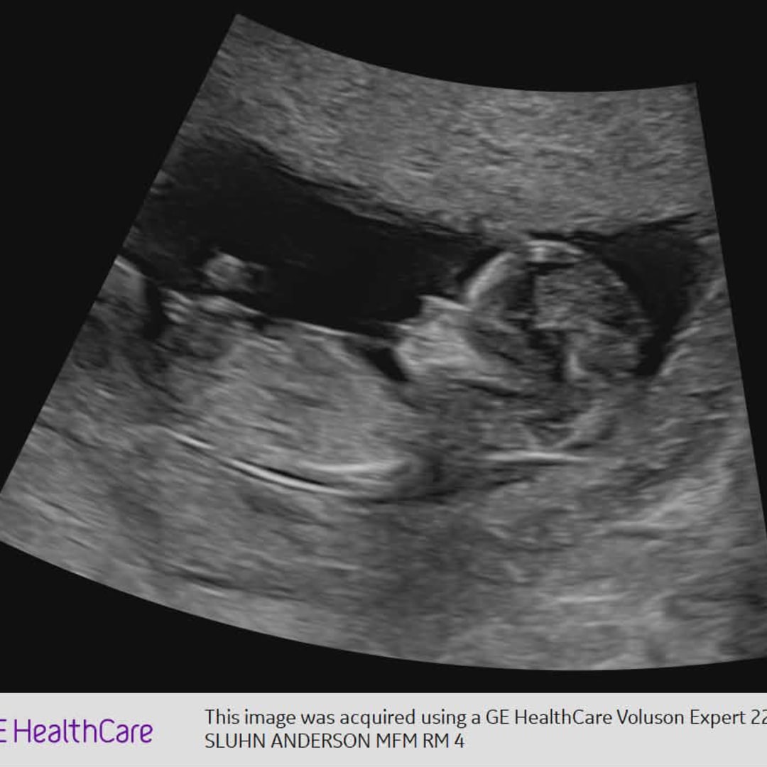 Photo shared by Brittany for their Babylist baby registry.