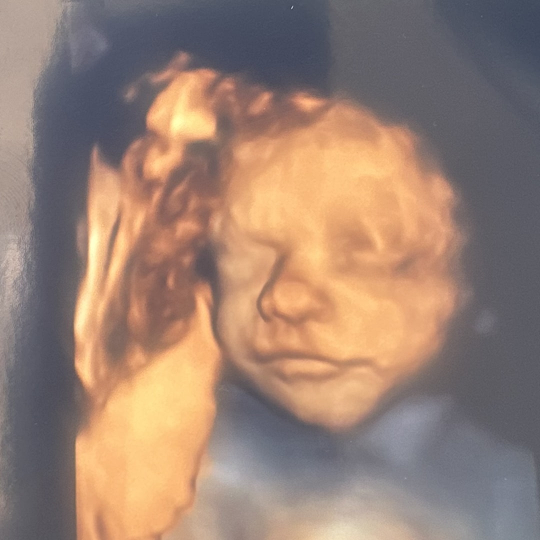 Photo shared by Breanna for their Babylist baby registry.