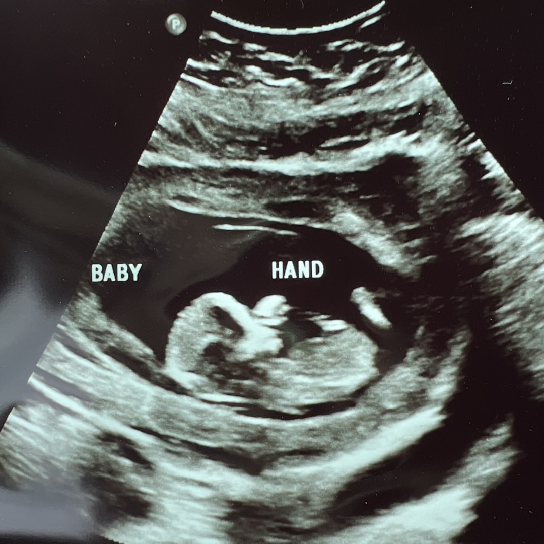 Photo shared by Shianne for their Babylist baby registry.