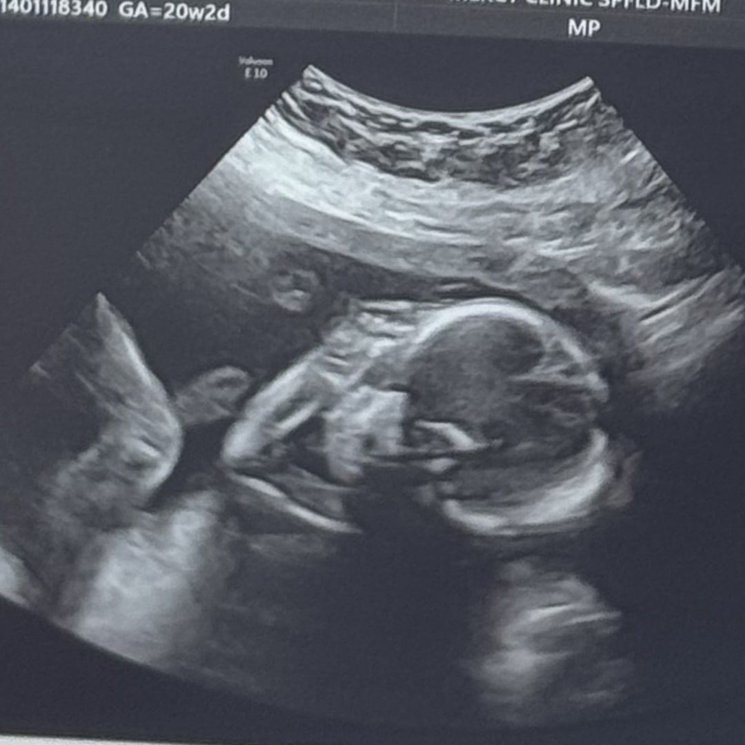 Photo shared by Aspen for their Babylist baby registry.