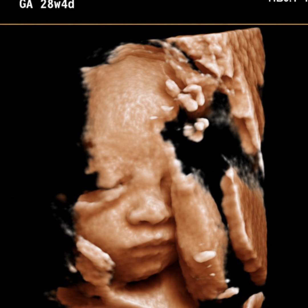 Photo shared by Jessica for their Babylist baby registry.