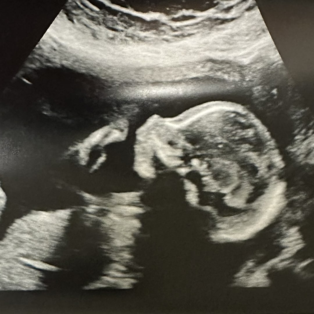 Photo shared by Kallie for their Babylist baby registry.