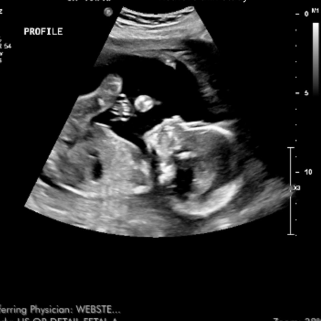 Photo shared by Haley for their Babylist baby registry.