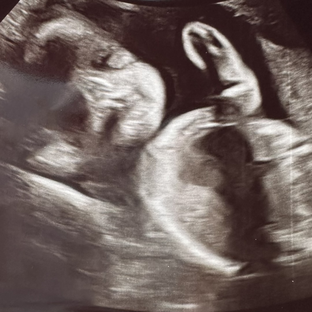 Photo shared by Abigail for their Babylist baby registry.