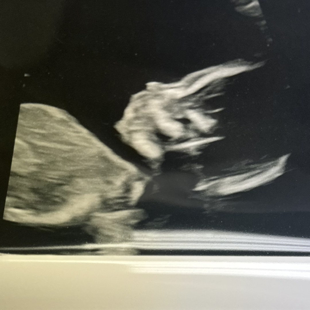 Photo shared by Becca for their Babylist baby registry.