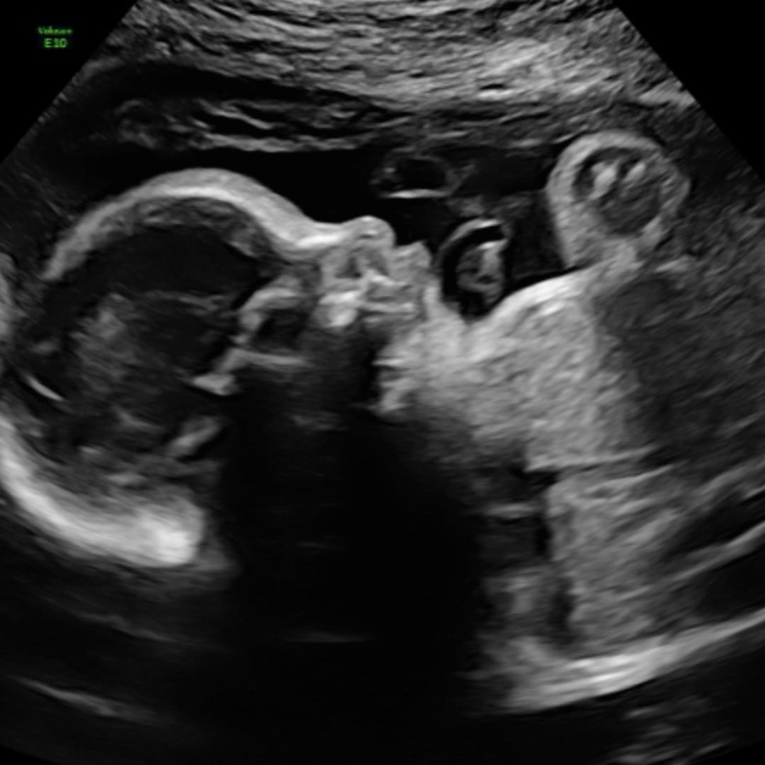 Photo shared by Theresa for their Babylist baby registry.