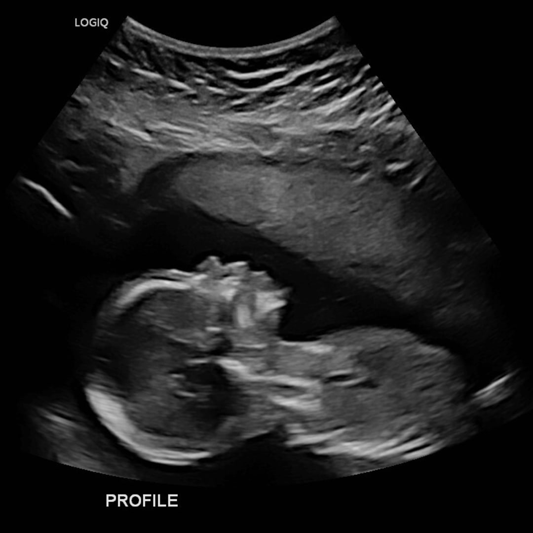 Photo shared by Aleeyah for their Babylist baby registry.