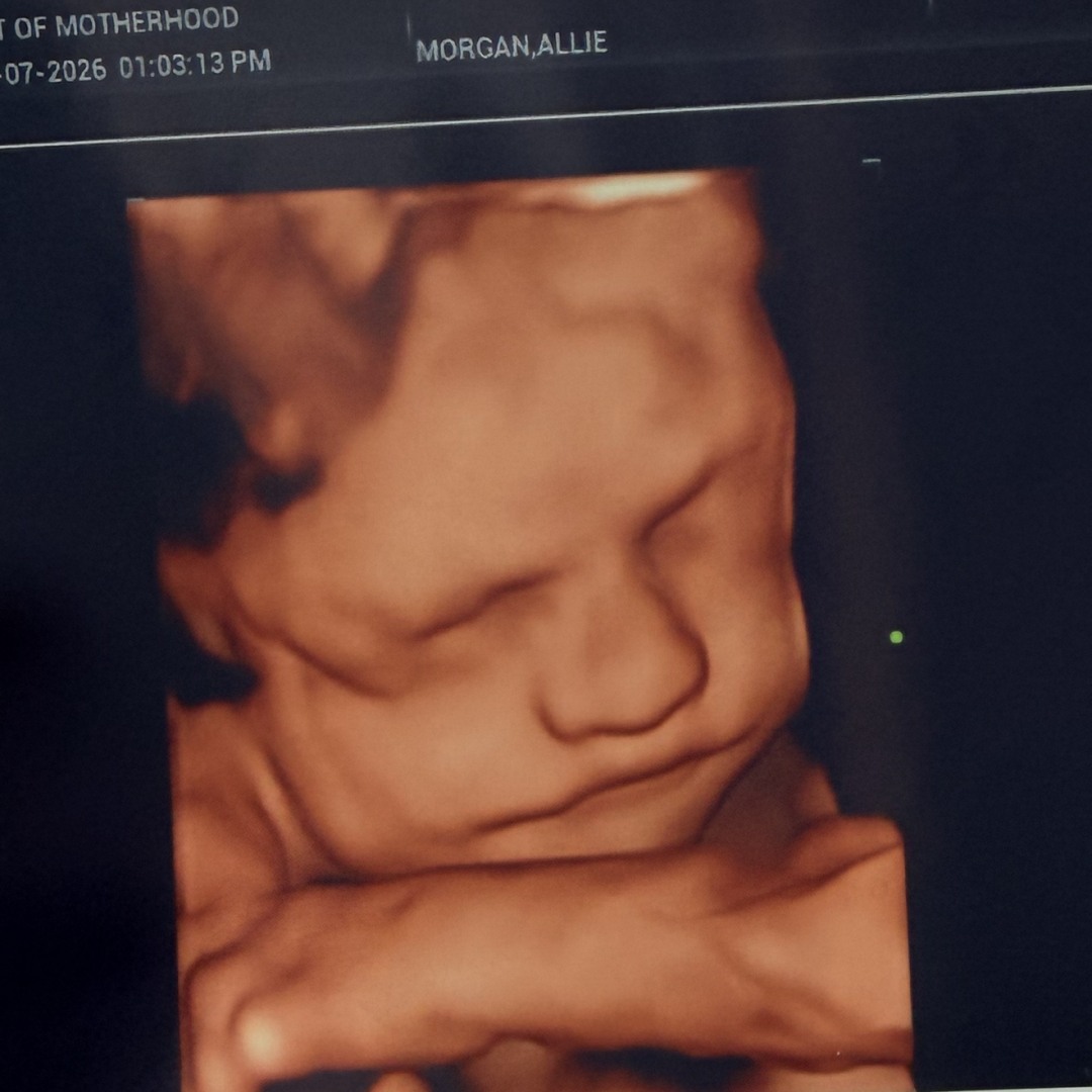 Photo shared by Allie for their Babylist baby registry.