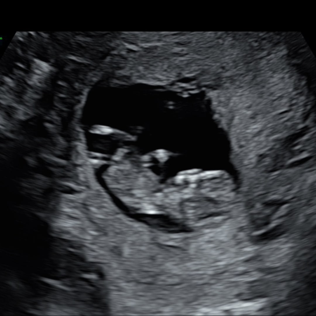 Photo shared by Jazanique for their Babylist baby registry.