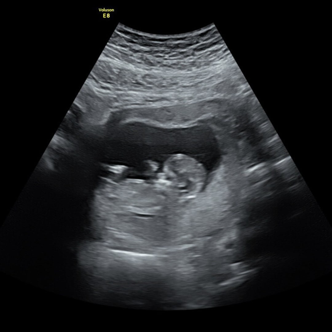 Photo shared by Aileen for their Babylist baby registry.