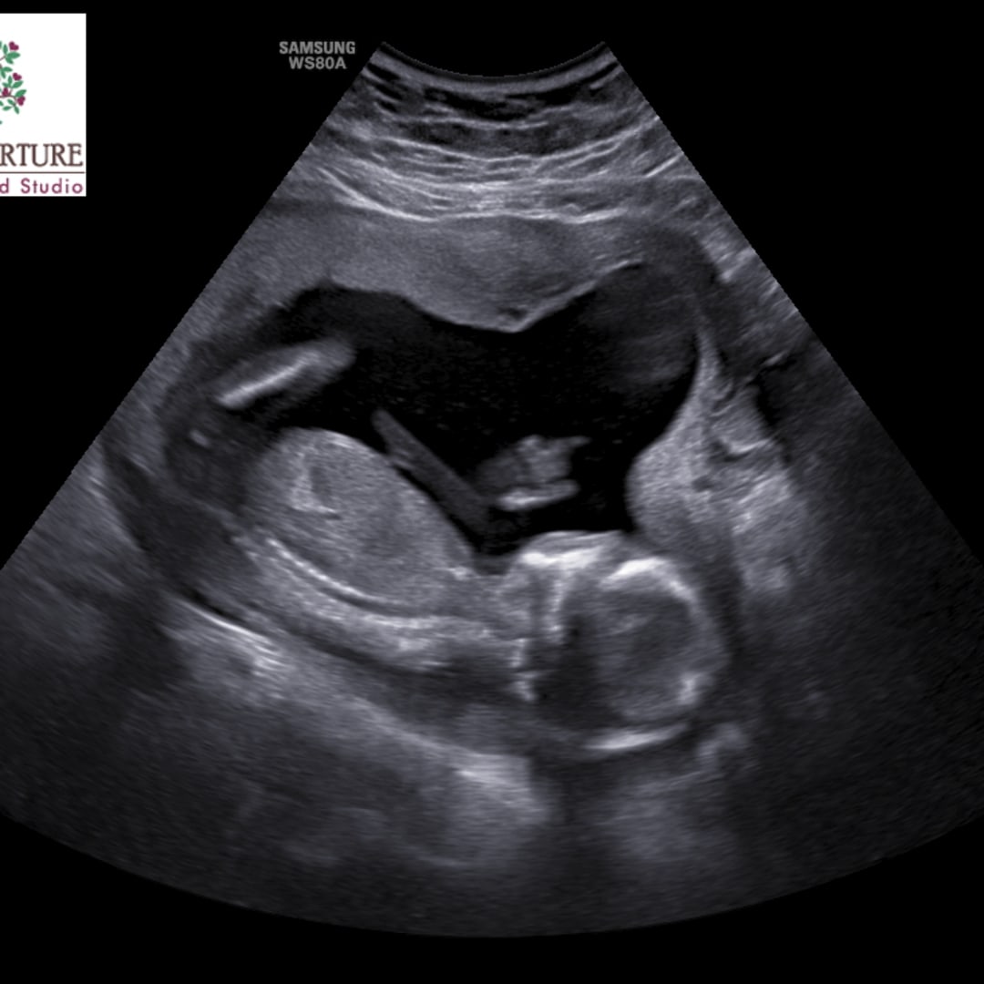 Photo shared by GINA for their Babylist baby registry.