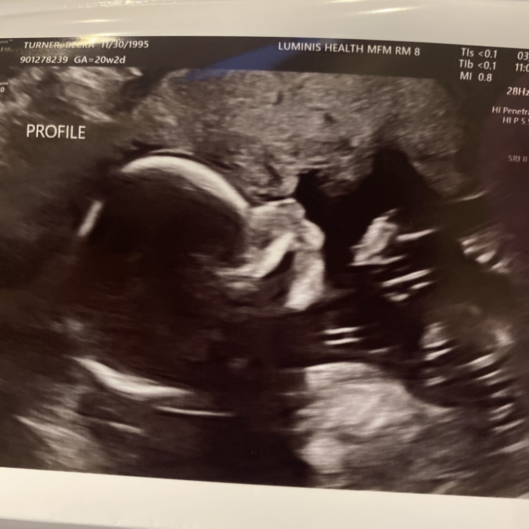 Photo shared by Becka for their Babylist baby registry.