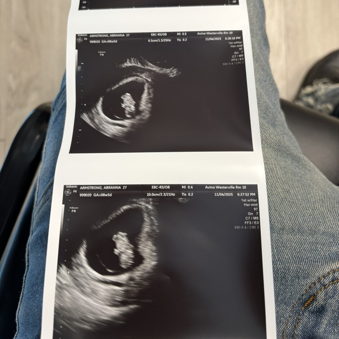 Photo shared by Abranna for their Babylist baby registry.