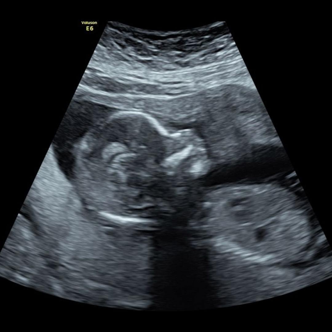 Photo shared by Mary for their Babylist baby registry.