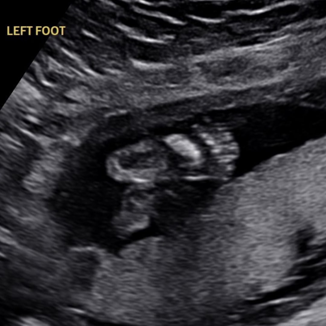 Photo shared by Jennifer for their Babylist baby registry.