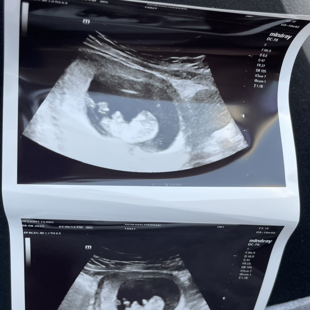 Photo shared by Hannah for their Babylist baby registry.