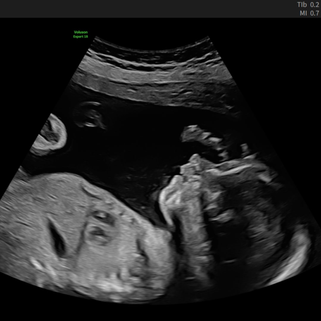 Photo shared by Connie for their Babylist baby registry.