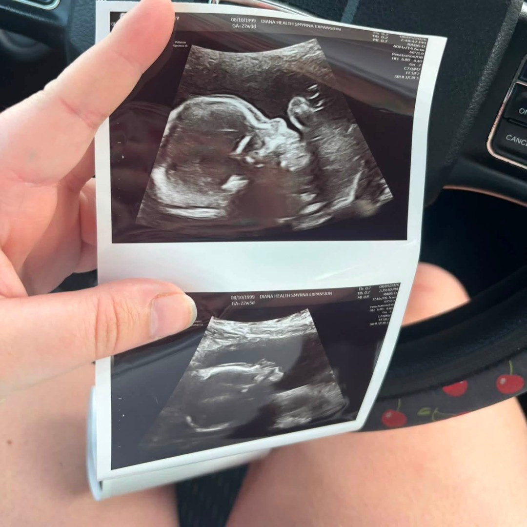 Photo shared by Calley for their Babylist baby registry.