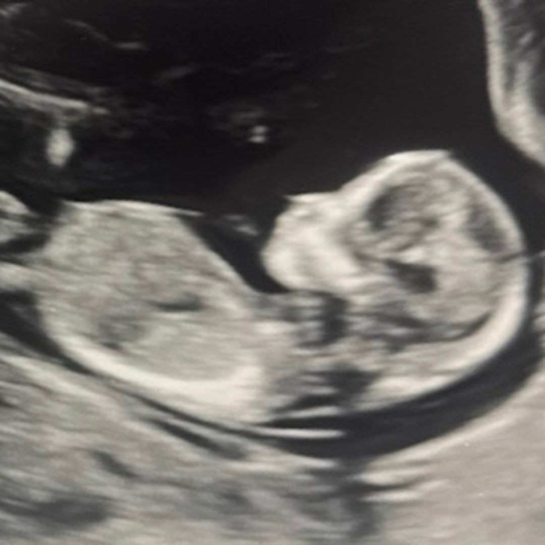 Photo shared by Cristina for their Babylist baby registry.