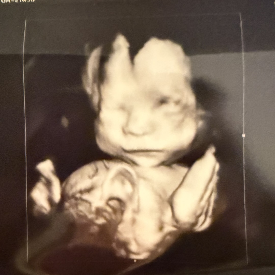 Photo shared by Savannah for their Babylist baby registry.