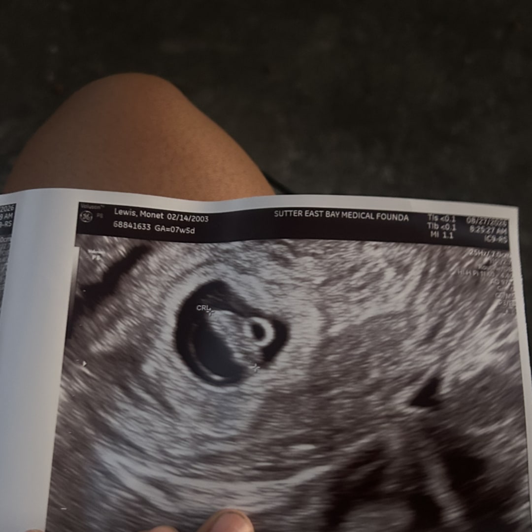 Photo shared by Valentina for their Babylist baby registry.