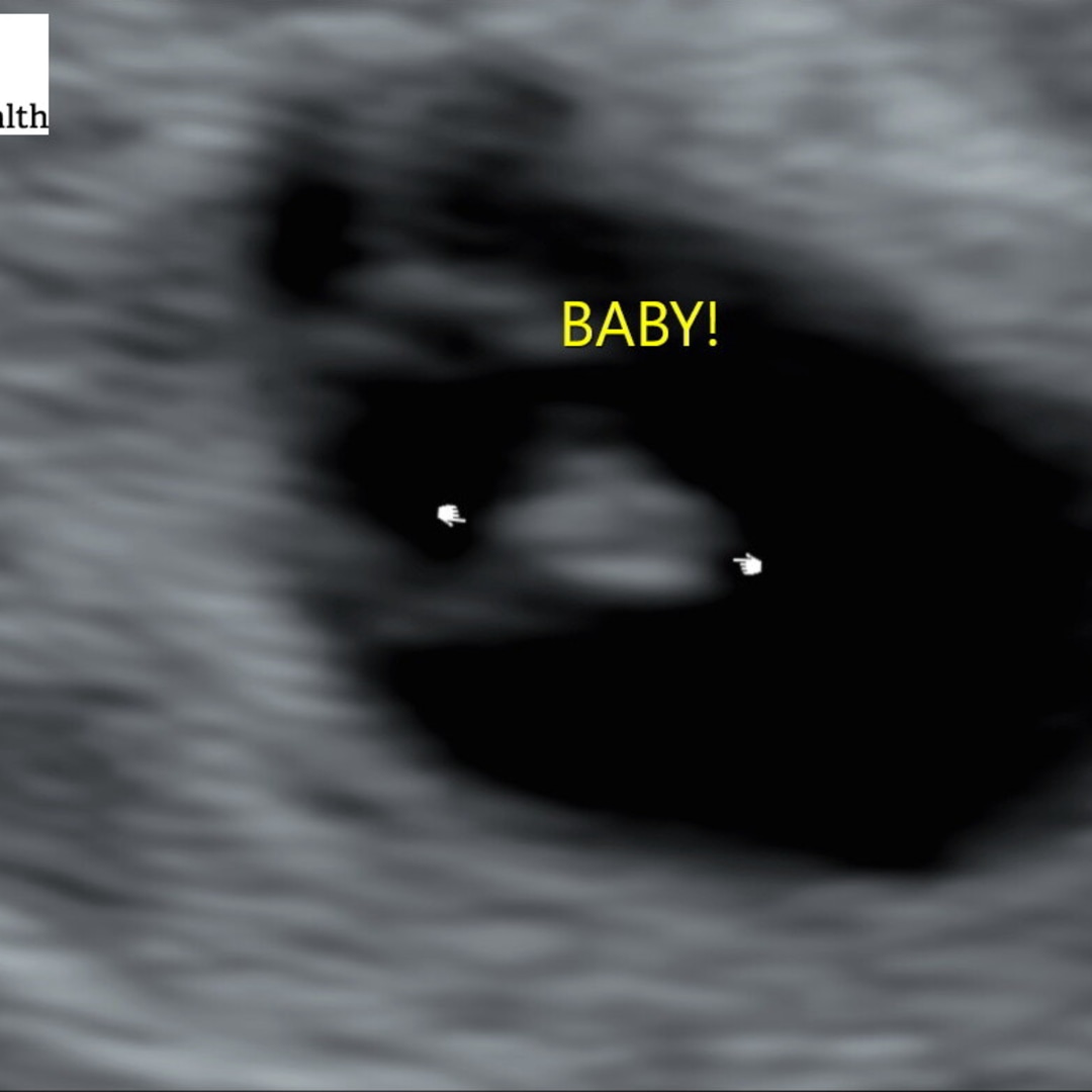 Photo shared by Jordan for their Babylist baby registry.