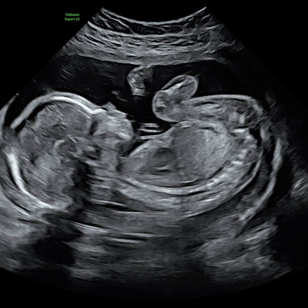 Photo shared by Meg for their Babylist baby registry.