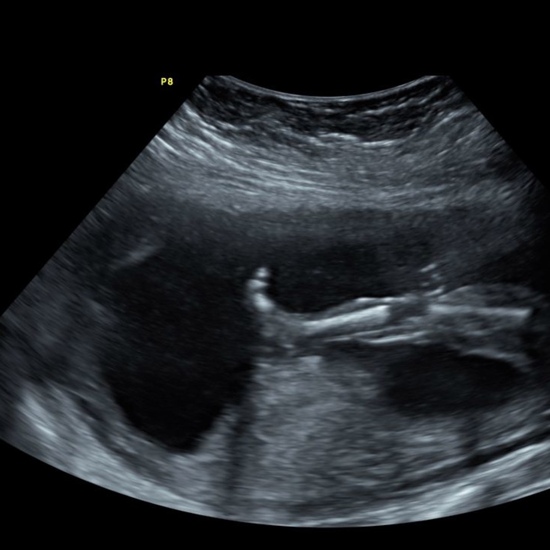 Photo shared by Hailey for their Babylist baby registry.