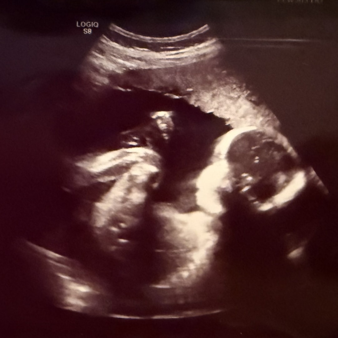 Photo shared by Alayah for their Babylist baby registry.