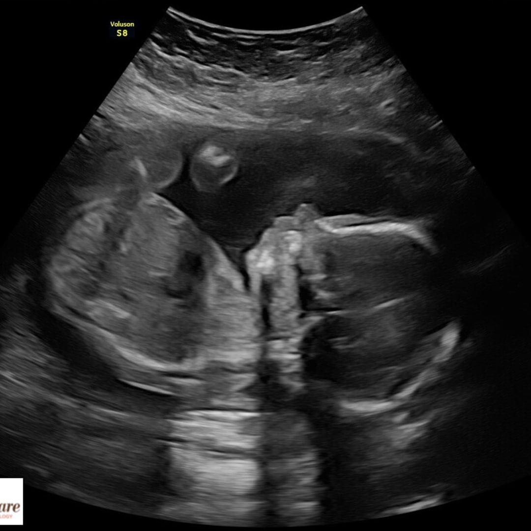 Photo shared by Sydney for their Babylist baby registry.